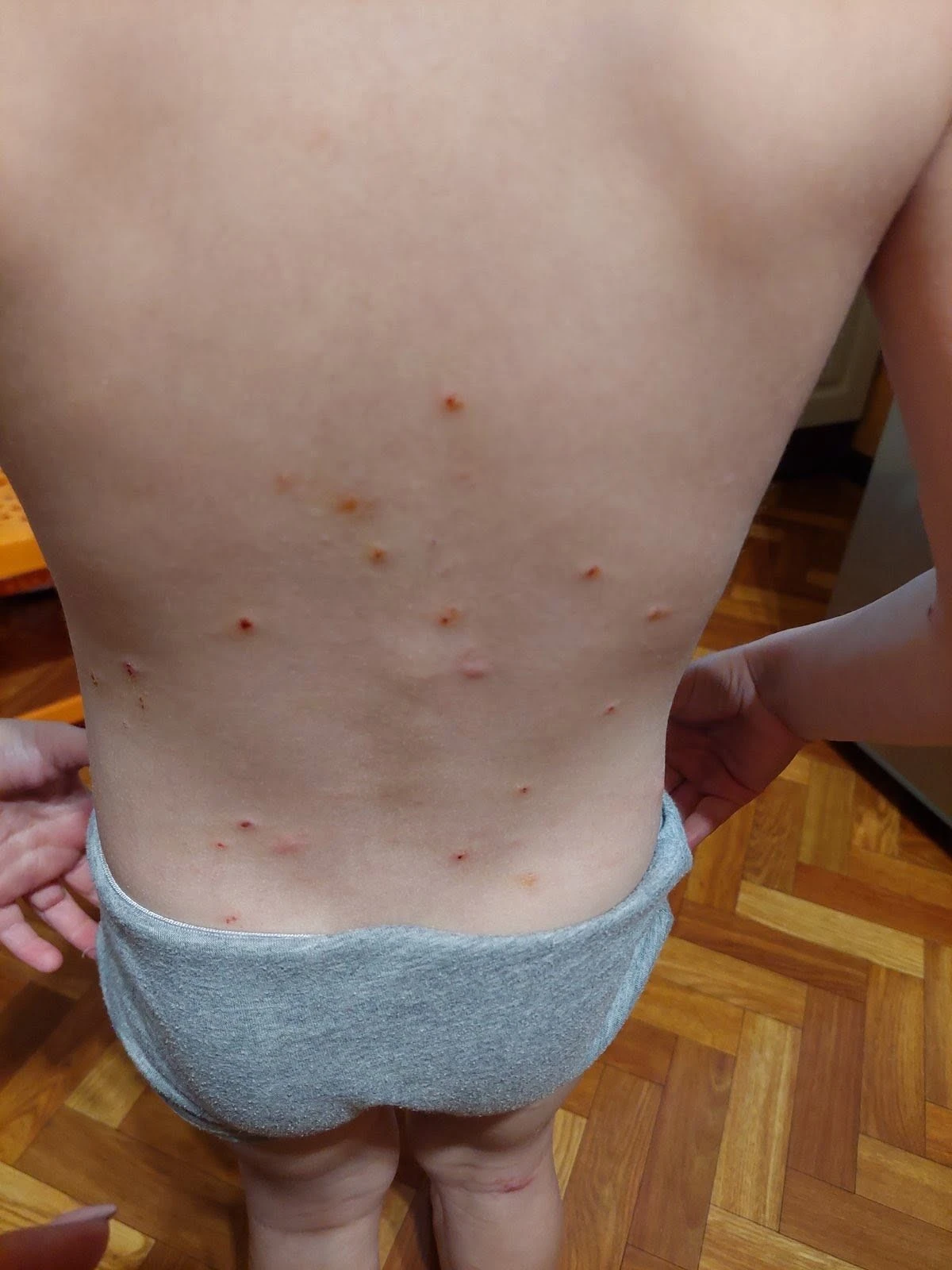 Миколаївці потерпають від атаки комах: паразити атакують під’їзди та житло